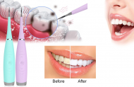 Ultradźwiękowa myjka do zębów